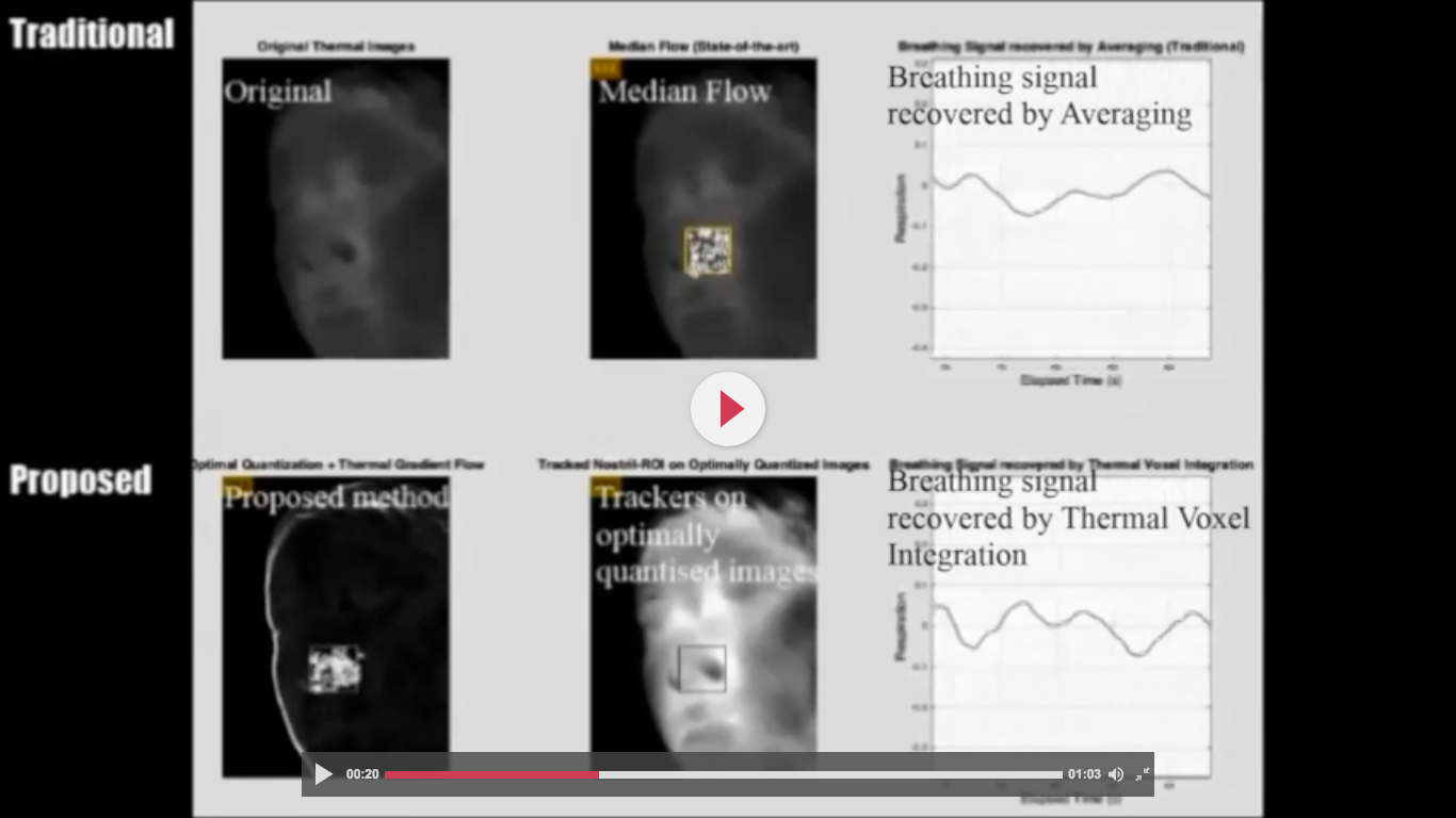 Biomedical Optics Express Journal Paper Supplementary Materials Dr