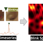 Rethinking Eye-Blink project